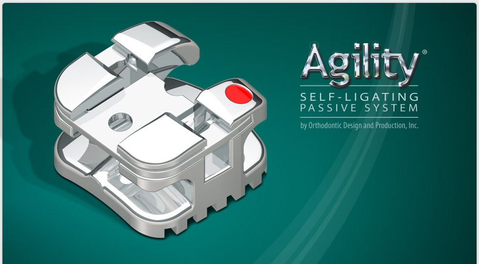 จัดฟัน Agility Braces จัดฟัน Agility Braces