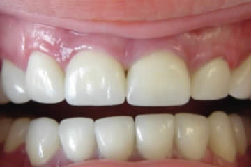 ทันตกรรมบูรณะ (Operative Dentistry)
