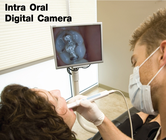 Intra Oral Digital Camera (การตรวจในช่องปากด้วยกล้องดิจิตอล) Intra Oral Digital Camera (การตรวจในช่องปากด้วยกล้องดิจิตอล)