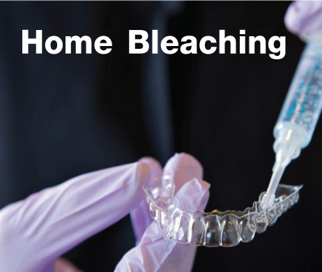 Home Bleaching For Yourself!! Home Bleaching For Yourself!!